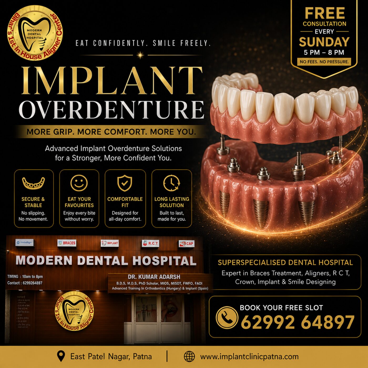 Implant supported overdenture Modern Dental Hospital Patna