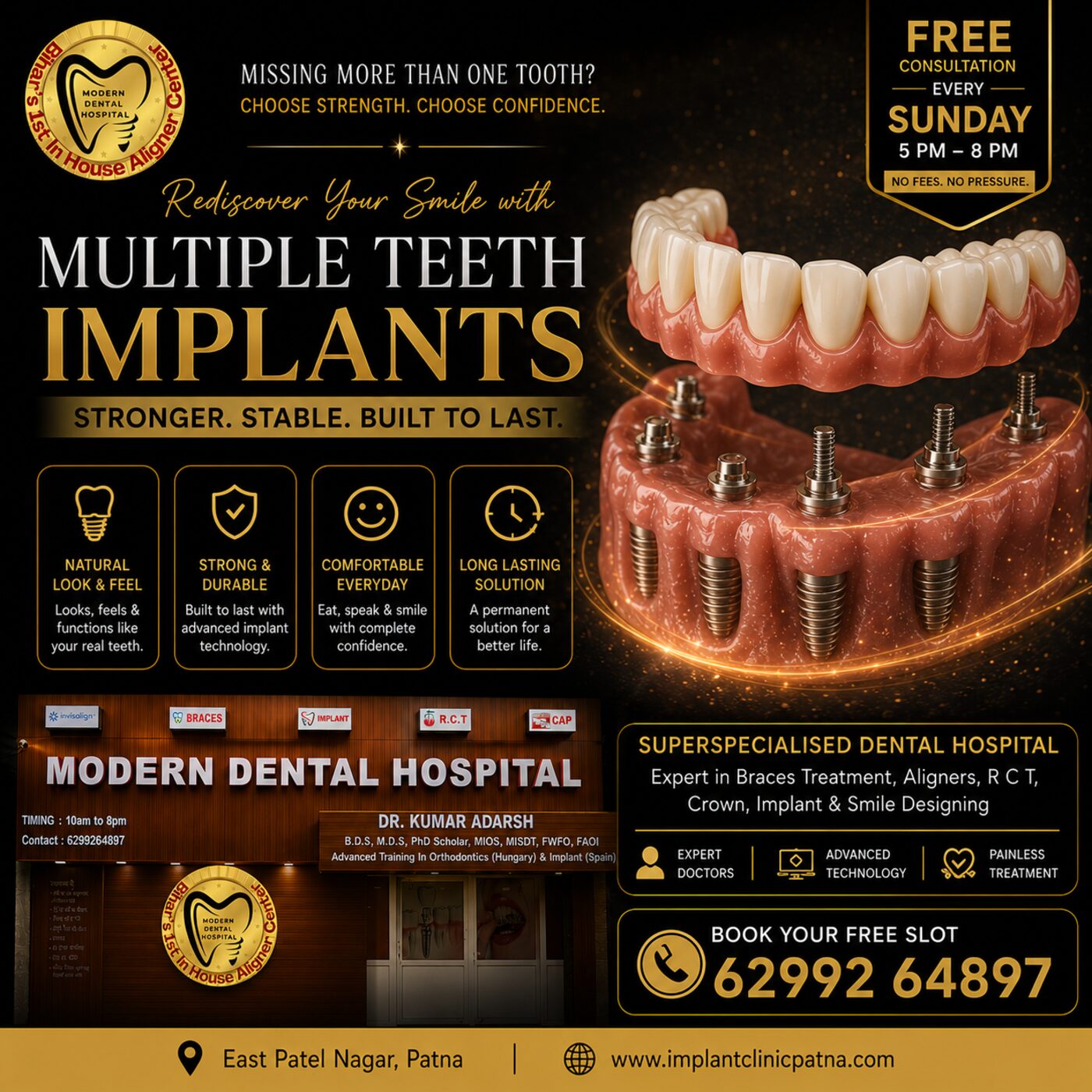 Multiple teeth implants Modern Dental Hospital Patna